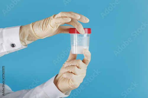The doctor holds a plastic jar of semen in his hand for analysis.