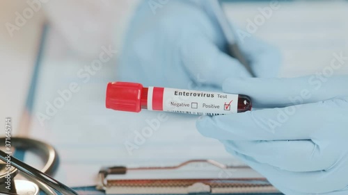 Doctor or laboratory technician holds in one hand laboratory positive blood test tube with enterovirus, other handwriting down results to patients medical record. Laboratory medical diagnostics photo