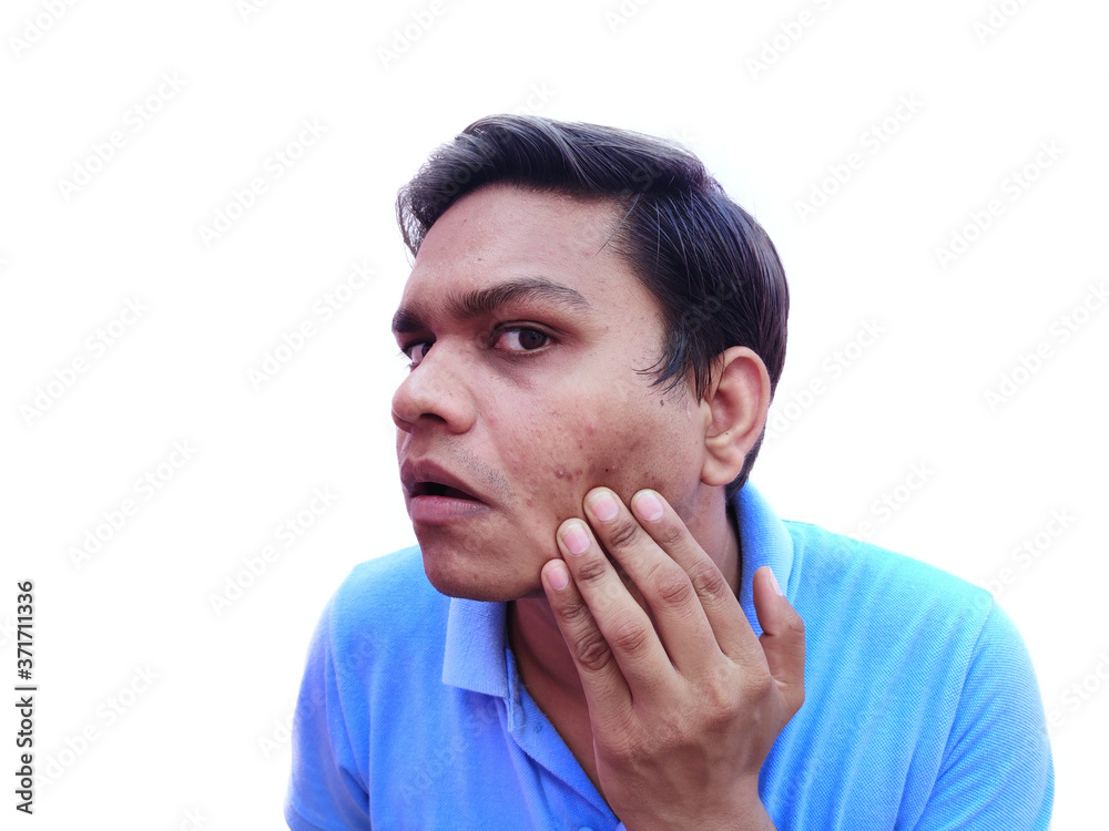 Young man having pimples checking marks on face Young man having pimples checking marks on face