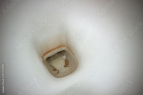 Dirty and stains on white toilet bowl