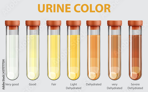 Illustration of urine color chart photo