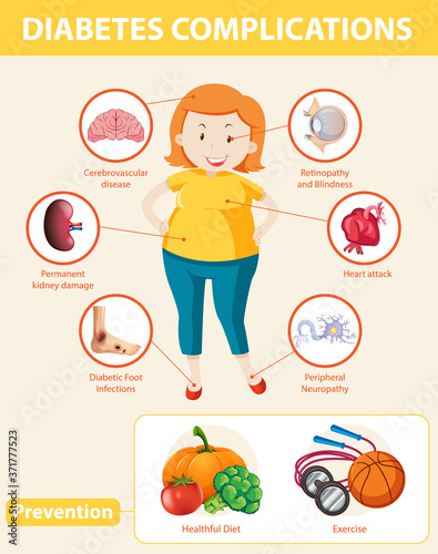 Medical infographic of diabetes complications and preventions