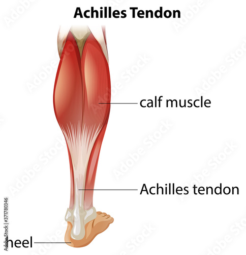 Medical infographic of achilles tendon photo
