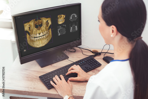 Dental 3D tomography, female dentist at office photo
