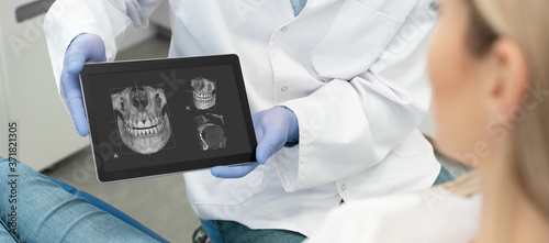 Photography Dentist showing teeth x-ray on tablet screen