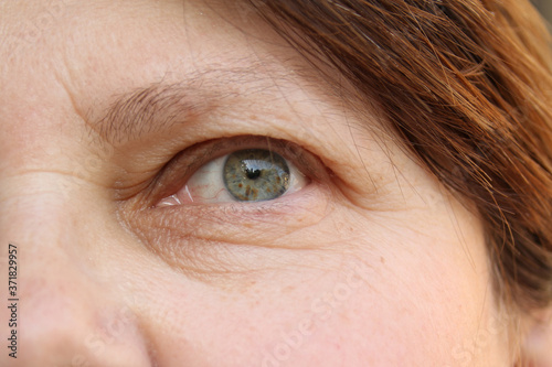 eyes of an elderly woman with wrinkles on the eyelids, part of the face close-up, overhang, the concept of age-related changes in human skin