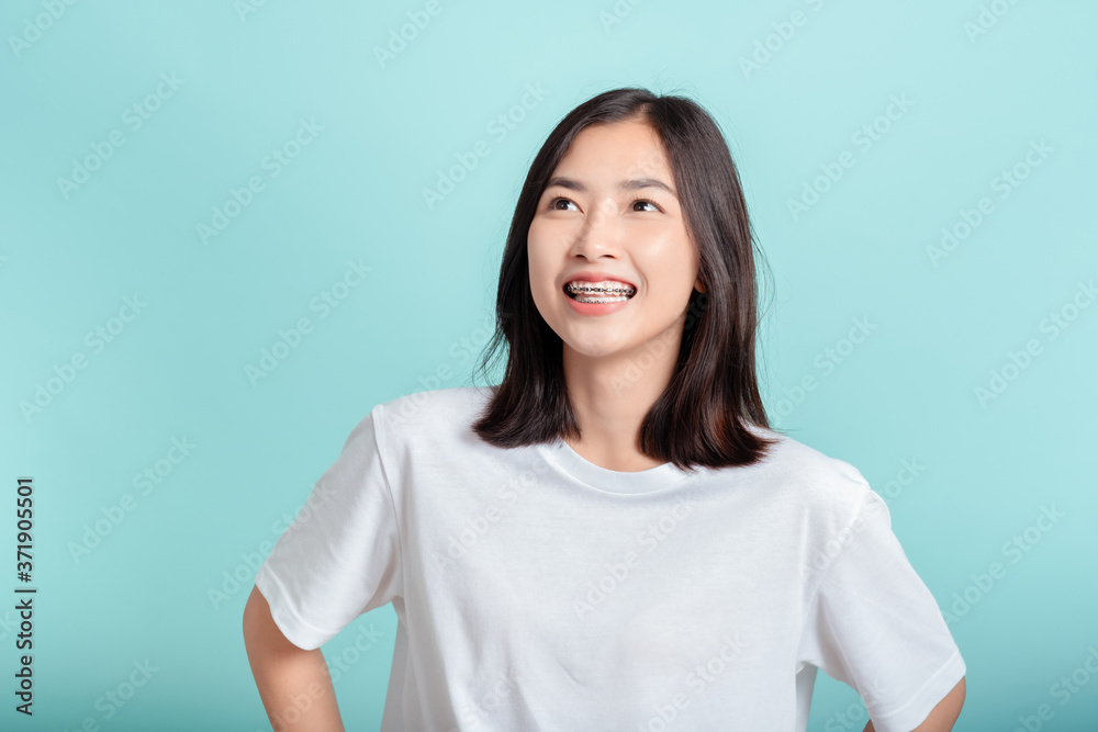 Dental braces of young asian woman wearing braces with white teeth concept. Dental braces of young asian woman wearing braces with white teeth concept.