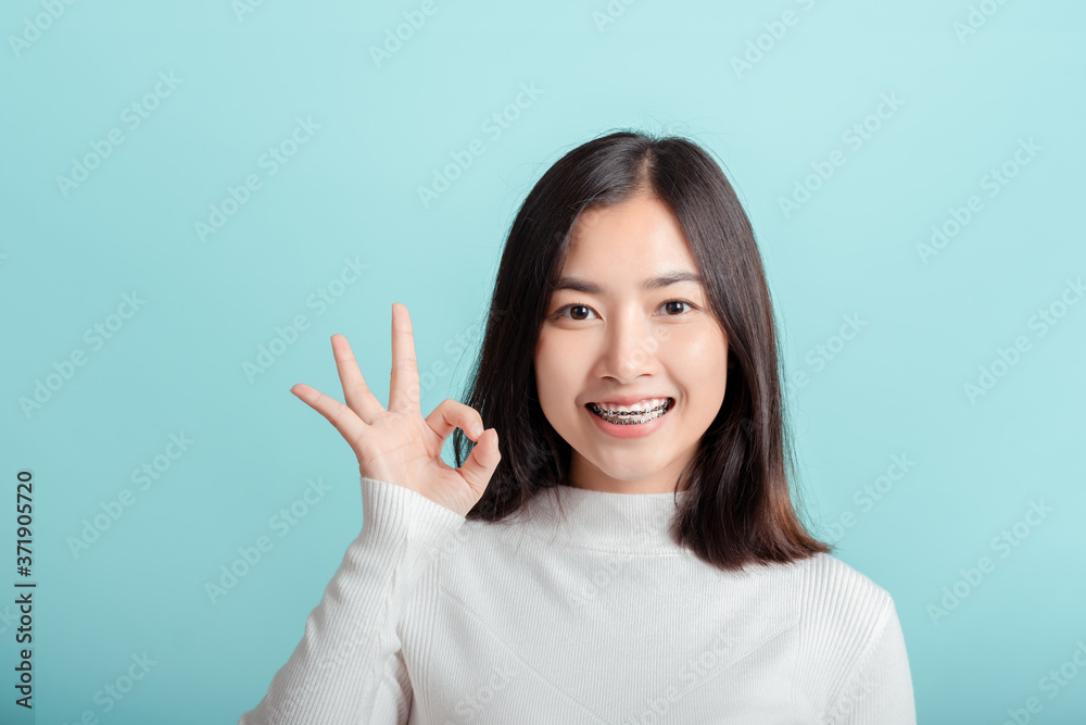 Dental braces of young asian woman okay emotion with white teeth. Dental braces of young asian woman okay emotion with white teeth.