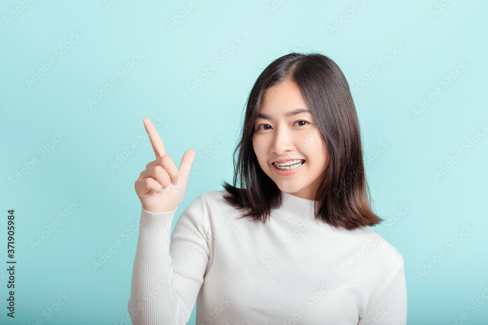 Dental braces of young asian woman wearing braces with white teeth concept. Dental braces of young asian woman wearing braces with white teeth concept.