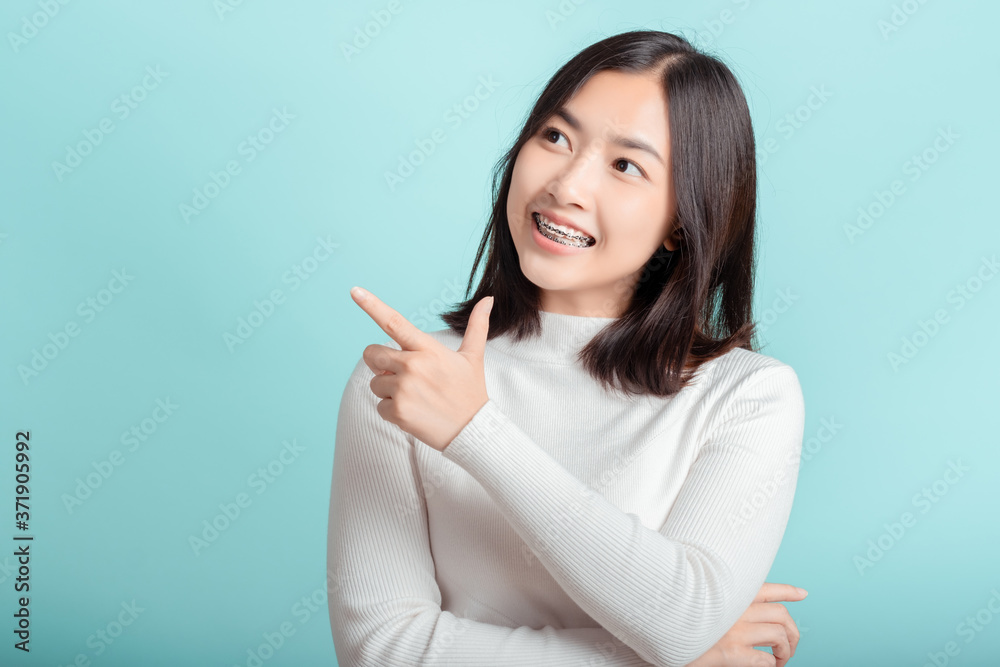 Dental braces of young asian woman wearing braces with white teeth concept. Dental braces of young asian woman wearing braces with white teeth concept.