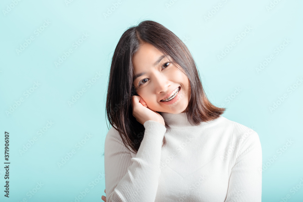 Dental braces of young asian woman wearing braces with white teeth concept. Dental braces of young asian woman wearing braces with white teeth concept.