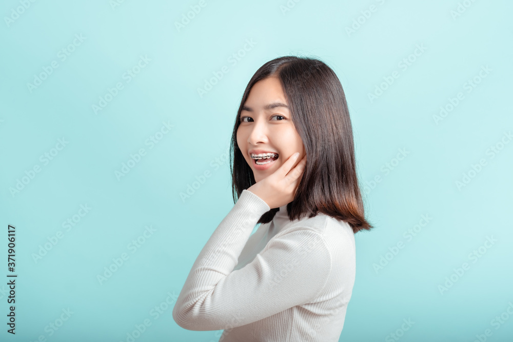 Dental braces of young asian woman wearing braces with white teeth concept. Dental braces of young asian woman wearing braces with white teeth concept.