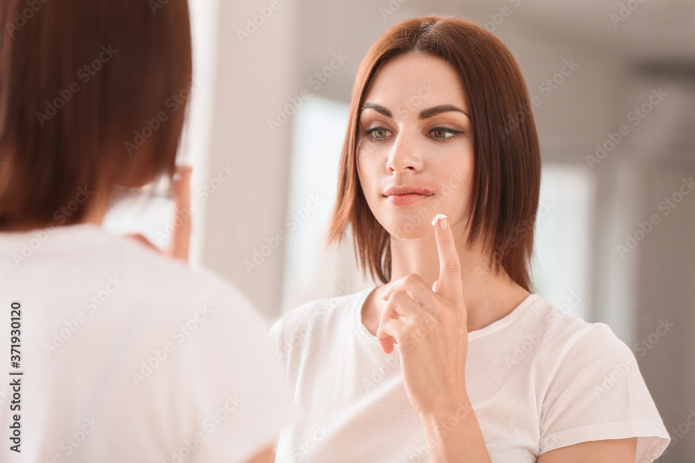 Young woman with cold sore applying remedy at home Young woman with cold sore applying remedy at home