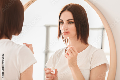 Young woman with cold sore applying remedy at home