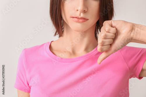 Young woman with cold sore showing thumb-down on light background