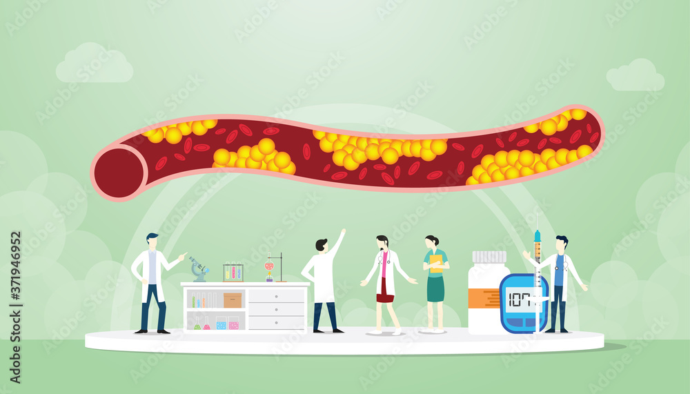 cholesterol in human vein with team people doctor analyze modern flat style cholesterol in human vein with team people doctor analyze modern flat style