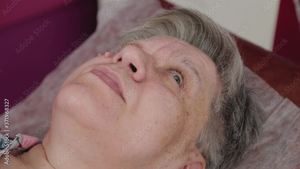Elderly woman with papillomas on her face at the medical center. Elderly woman with papillomas on her face at the medical center.