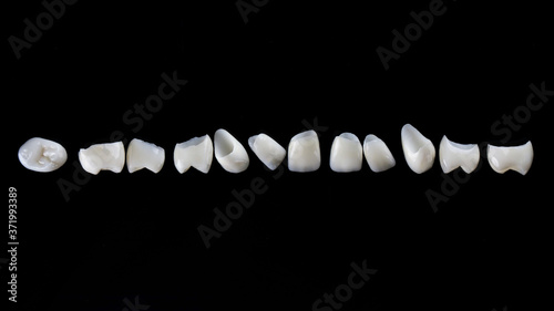 dental veneers of the upper jaw made of ceramic on a black background, top view