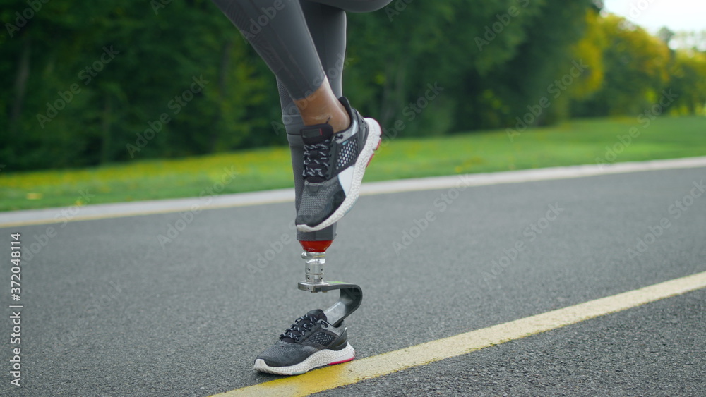 Disabled woman doing high knee taps during workout. Girl legs training in park Disabled woman doing high knee taps during workout. Girl legs training in park