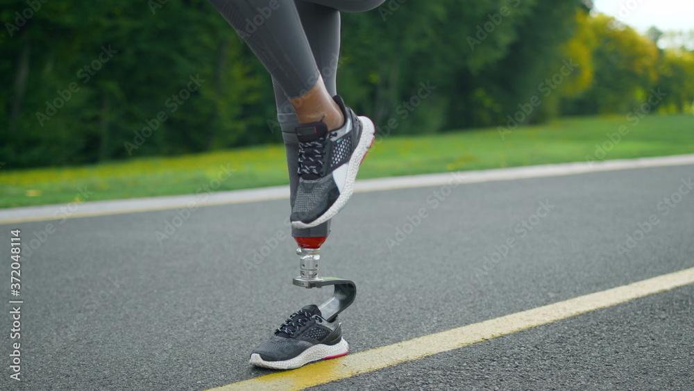 Disabled woman doing high knee taps during workout. Girl legs training in park