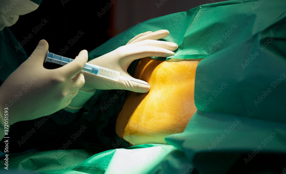 Anesthetic injection,Anesthesiologist or doctor prepping area where her