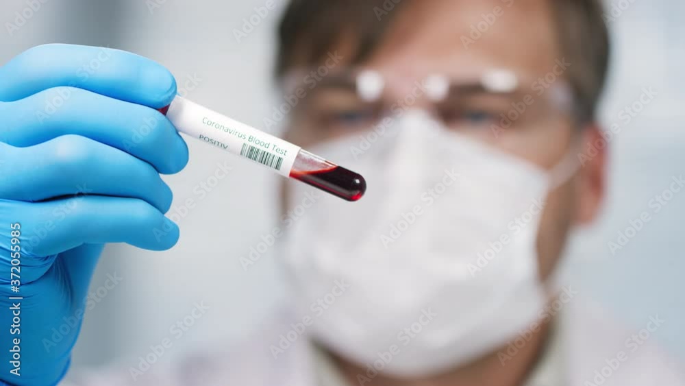 Close up with rack focus of male scientist in protective goggles and face mask looking at blood sample in test tube Close up with rack focus of male scientist in protective goggles and face mask looking at blood sample in test tube