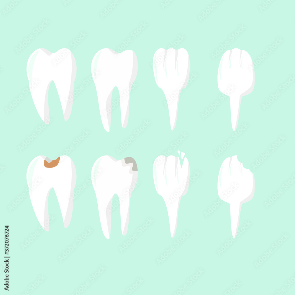 Set of teeth in flat style, healthy teeth and decayed teeth, dentistry and dental health, vector illustration for design and creativity