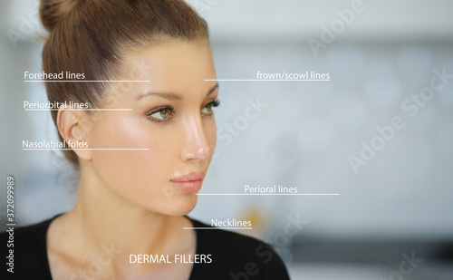 dermal filler treatments .Hyaluronic acid injections for specific areas.Correct wrinkles	 photo