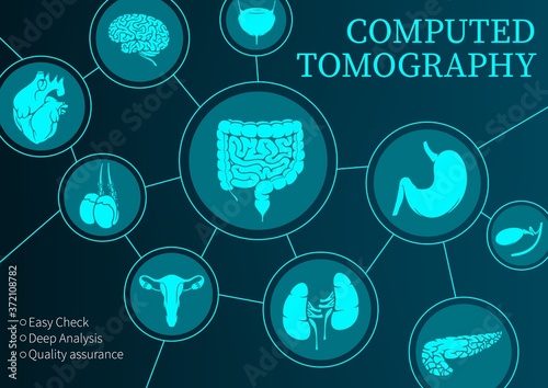 Computed tomography, medicine, vector MRI diagnostics and CT scan of internal organs, diagnostic medicine. Magnetic resonance imaging of kidneys, bladder, testicles and stomach, pancreas, neon poster