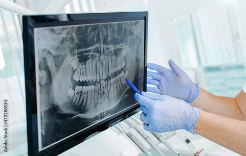 Hands doctor dentist in gloves show the teeth on x-ray on digital screen in dental clinic on light background with medical equipment. Smile healthy teeth concept, close up photo
