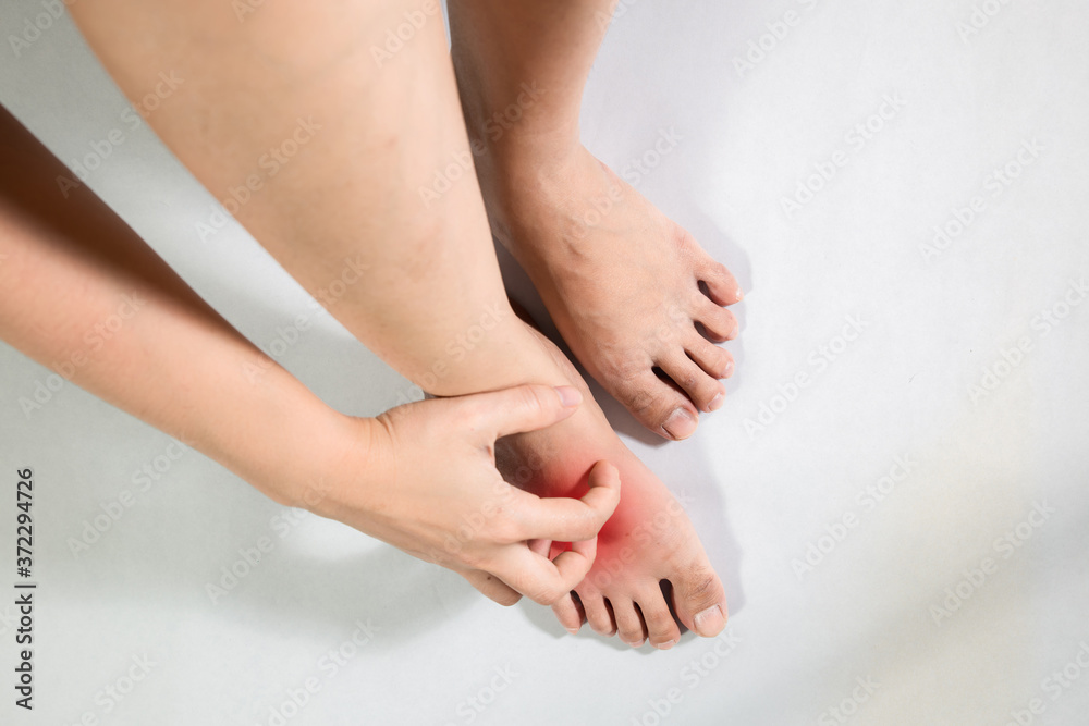 Woman hand scratching on feet isolated on white background. Woman hand scratching on feet isolated on white background.