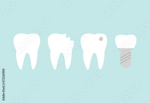 Teeth set line. Healthy white tooth, broken, ill with caries tartar and dental implant teeth.