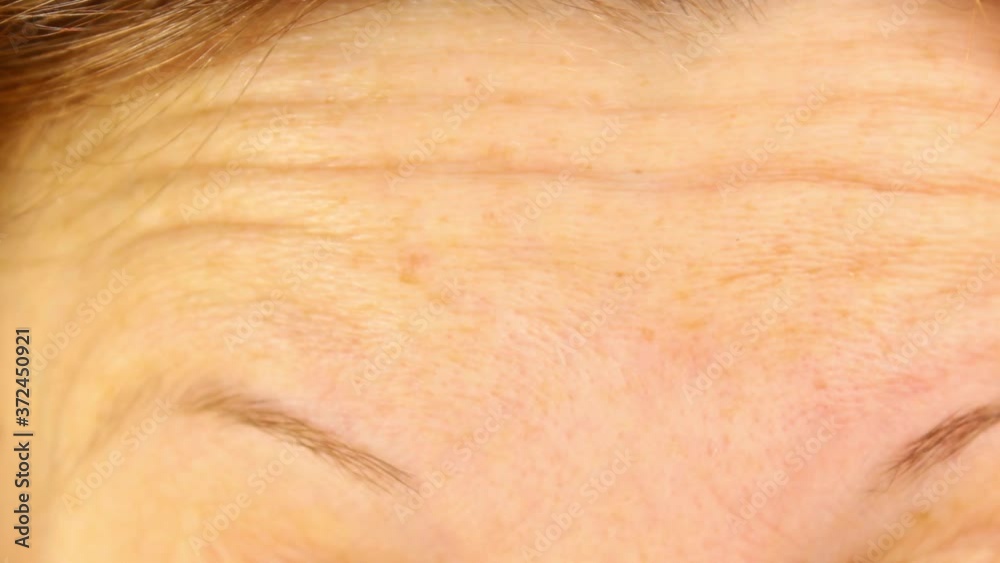 The woman furrows her brow. Emotions on the forehead. Close-up, selective shot. The woman furrows her brow. Emotions on the forehead. Close-up, selective shot.