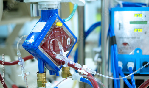 closeup oxygenator of ECMO (Extracorporeal membrane oxygenation) in critical care unit (CCU
