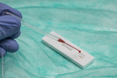 Unrecognizable medic in surgical glove examining blood sample while using pipette and professional tool for rapid test on COVID 19