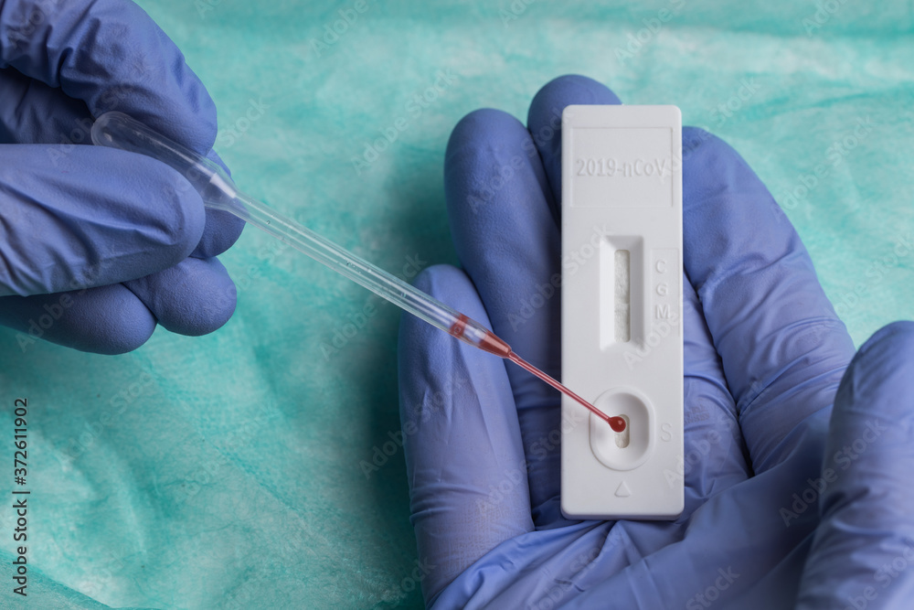 © Ramon Lopez/ADDICTIVE STOCK - Unrecognizable medic in surgical glove examining blood sample while using pipette and professional tool for rapid test on COVID 19 © Ramon Lopez/ADDICTIVE STOCK - Unrecognizable medic in surgical glove examining blood sample while using pipette and professional tool for rapid test on COVID 19