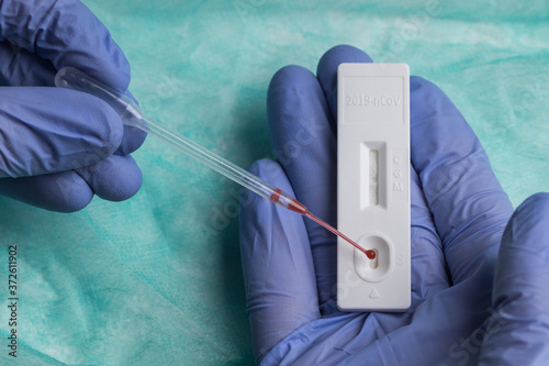 Unrecognizable medic in surgical glove examining blood sample while using pipette and professional tool for rapid test on COVID 19