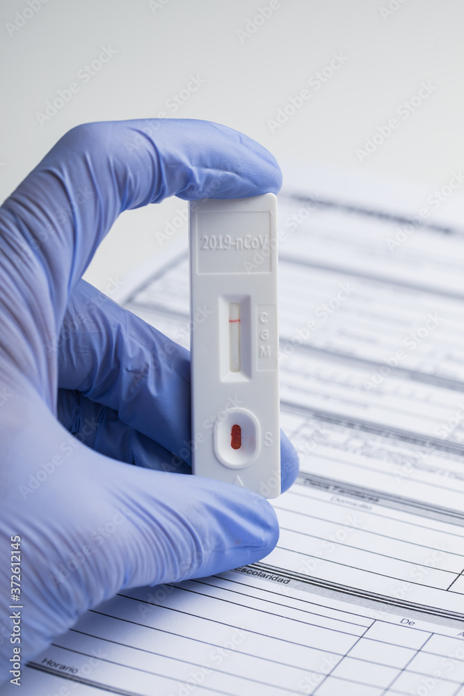 From above of anonymous doctor in medical gloves with results of rapid blood test on coronavirus in clinic From above of anonymous doctor in medical gloves with results of rapid blood test on coronavirus in clinic