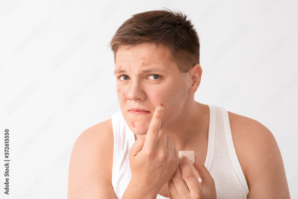 Teenage boy with remedy for acne on light background Teenage boy with remedy for acne on light background