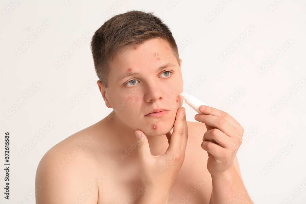 © Pixel-Shot - Teenage boy with remedy for acne on light background