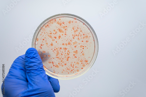 Scientists are studying the microbiota of the intestines and stomach of a person on a Petri dish, close-up.