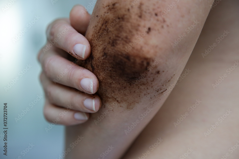 DIY Coffee scrub. Beauty skin care. Young woman putting coffee scrub on dry elbow skin. DIY Coffee scrub. Beauty skin care. Young woman putting coffee scrub on dry elbow skin.