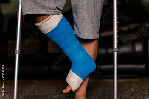 Male stood on 1 foot with crutches supportiing weight and stability At home photo