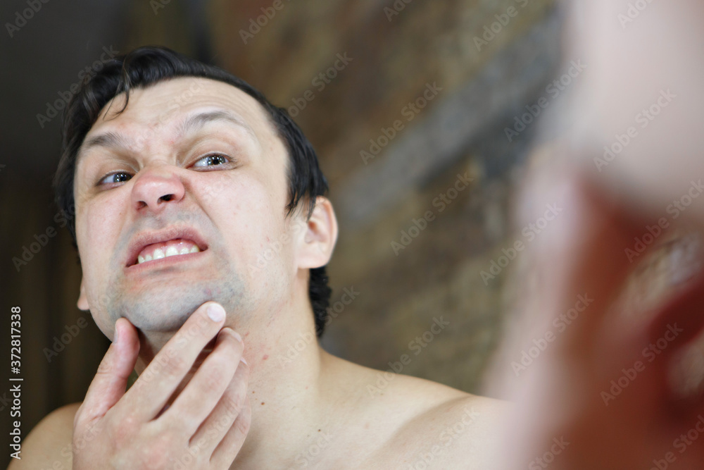 Obraz premium the man squeezes out a pimple on his face. the guy looks in the mirror. morning treatments in the bathroom. copyspace
