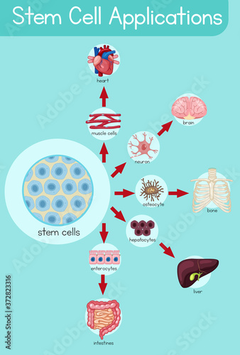 Informative poster of stem cell applications