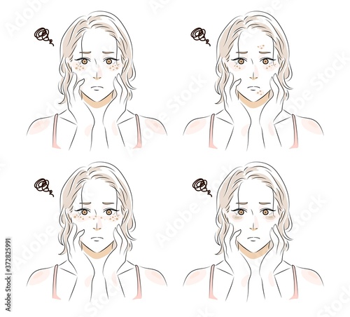 シミの種類　女性イラスト