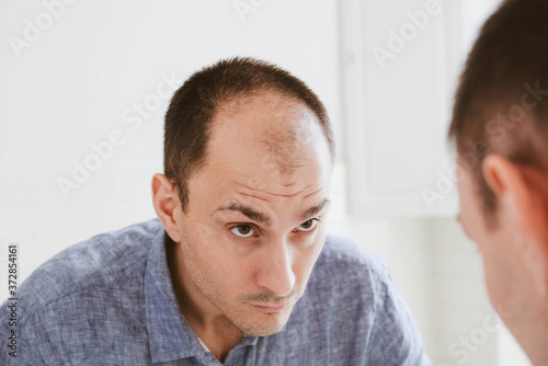 Young man looking at mirror worry about balding.