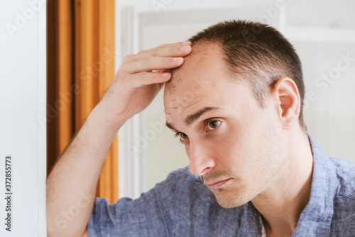 Young man looking at mirror worry about balding.