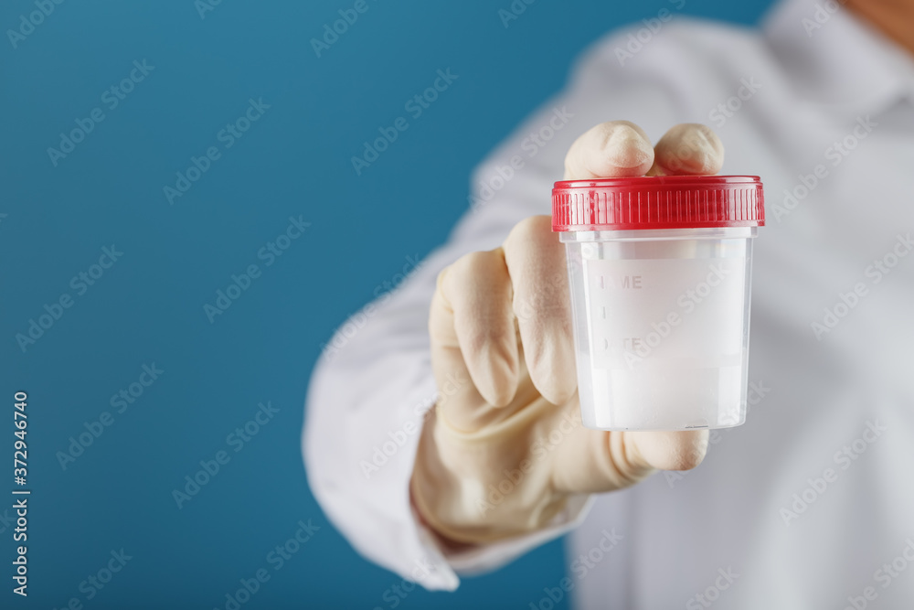 A doctor's gloved hand holding a bottle of a container with a sperm sample for medical analysis.