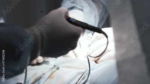 Team surgeon at work in operating room. Action. Close up of penis enlargement surgery to increase the size of a man penis, concept of male enhancement.